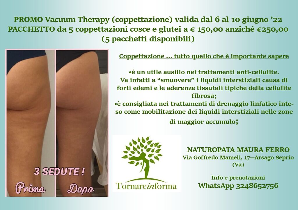 4913690 PROMO Vacuum Therapy